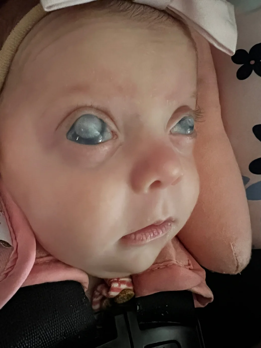 Olhos da Helena — glaucoma